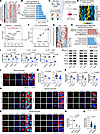 Multi-omics profiling identifies BAF60a inactivation as a key mediator of β