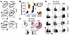 Chemokine receptor expression by liver-infiltrating CD4P/I(hi) T cells.