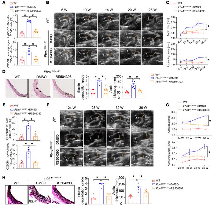 Suppression of CCR2 reduced CX3CR1+ macrophage accumulation and subseque...