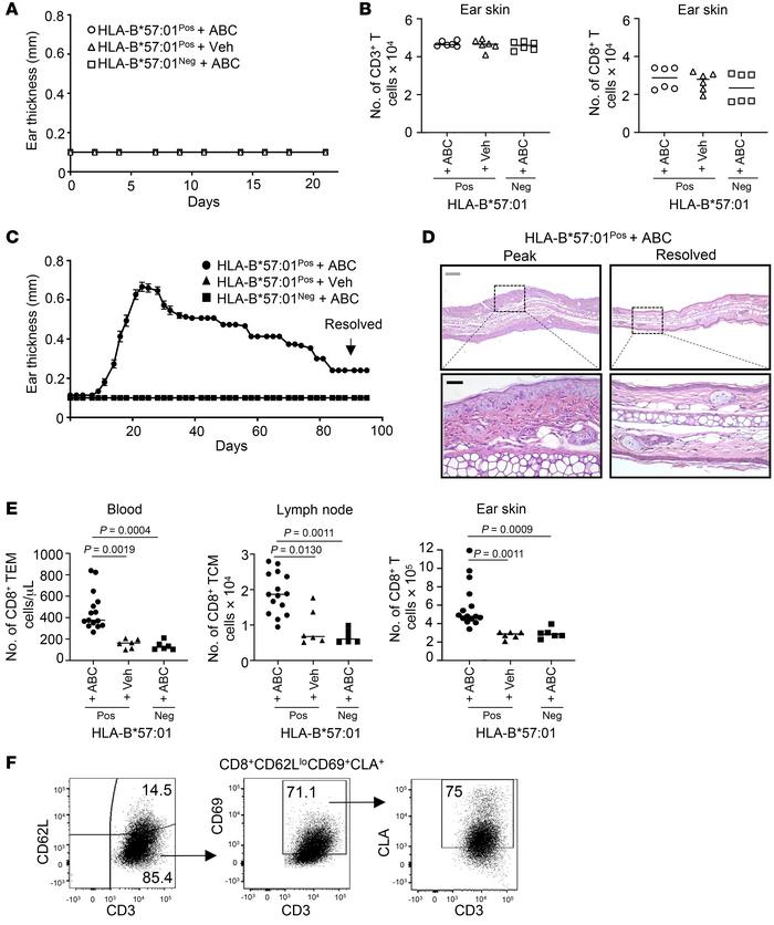 Drug-specific skin TRMs are generated in mouse skin after disease resolu...