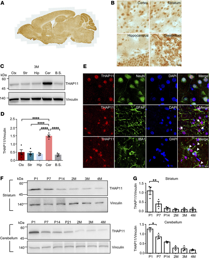 Characterization of THAP11 expression in the brain.
(A) Immunohistochemi...