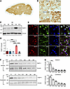 Characterization of THAP11 expression in the brain.