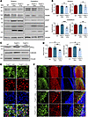 Mutant THAP11 with polyQ expansion causes cerebellar neuronal loss in mice.