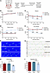 Mutant THAP11 with polyQ expansion causes motor deficits in mice.