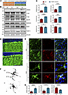 Microglial activation in THAP11-47Q KI mice.