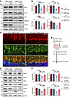 Loss of TREM2 attenuates mutant THAP11 neurotoxicity.