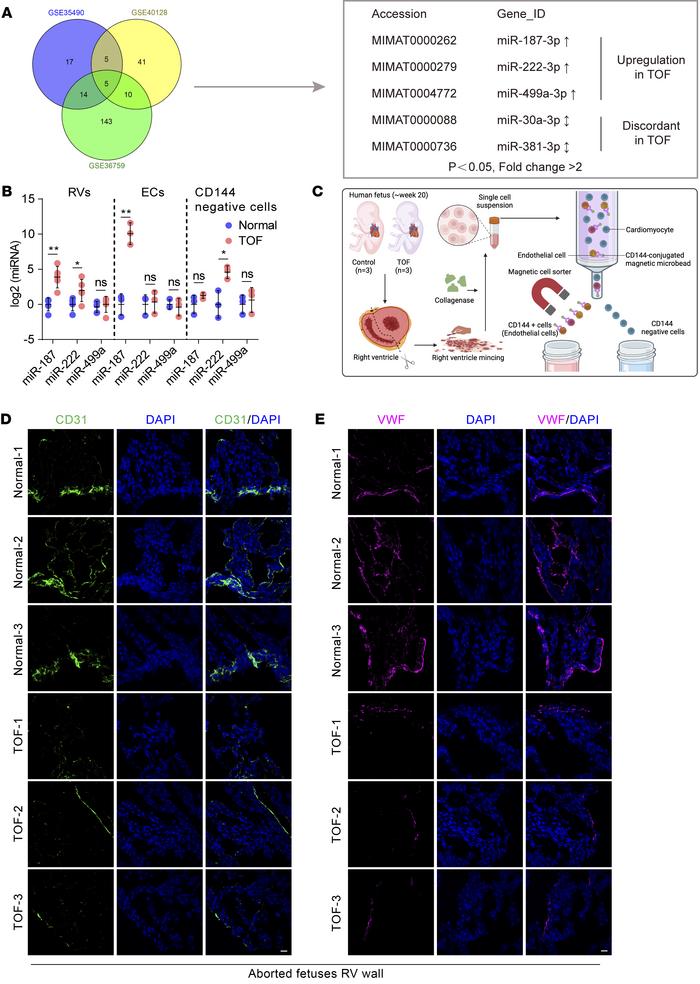 Upregulation of miR-187 expression in the hearts of fetuses with TOF.
(A...
