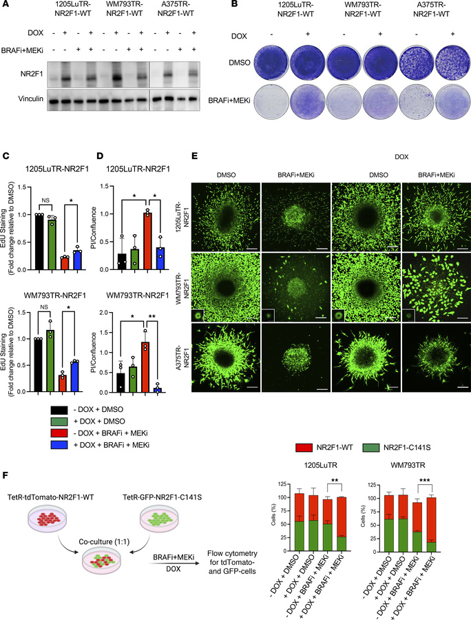 NR2F1 overexpression minimizes tumor inhibition effects by BRAFi and MEK...