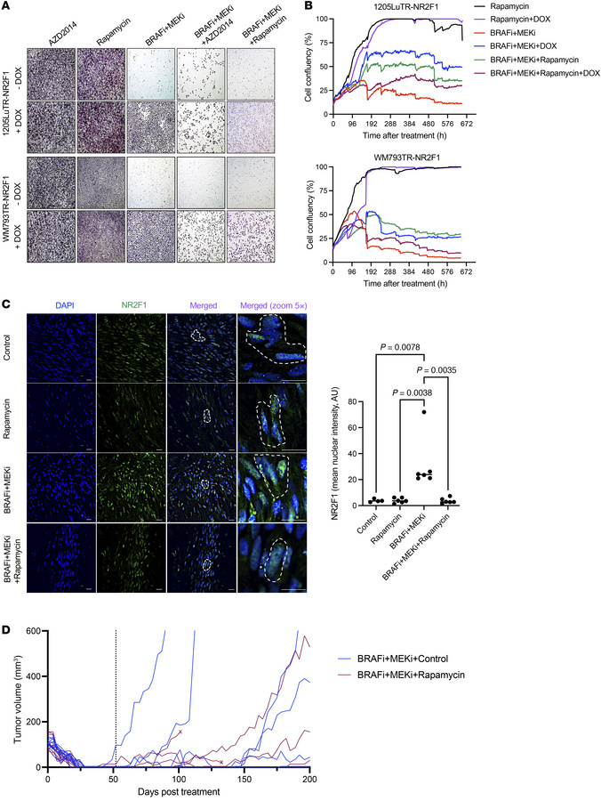 Rapamycin targets NR2F1-overexpressing drug-tolerant cells and delays tu...