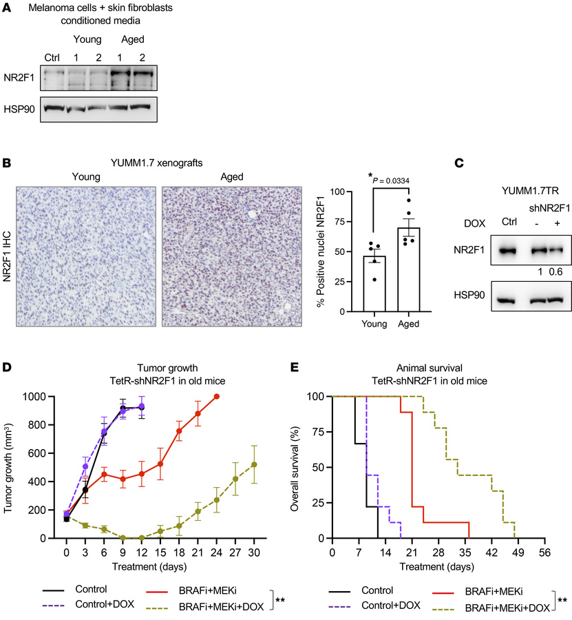 NR2F1 is overexpressed in aged BRAF-mutant melanoma models.
(A) NR2F1 pr...