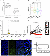 NR2F1 is highly expressed in melanoma lesions of patients on BRAFi + MEKi t