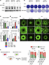 NR2F1 overexpression minimizes tumor inhibition effects by BRAFi and MEKi t