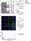 Rapamycin targets NR2F1-overexpressing drug-tolerant cells and delays tumor