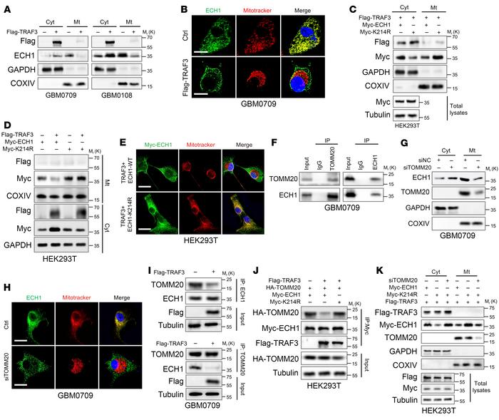 TRAF3-mediated ubiquitination of ECH1 inhibits its mitochondrial translo...