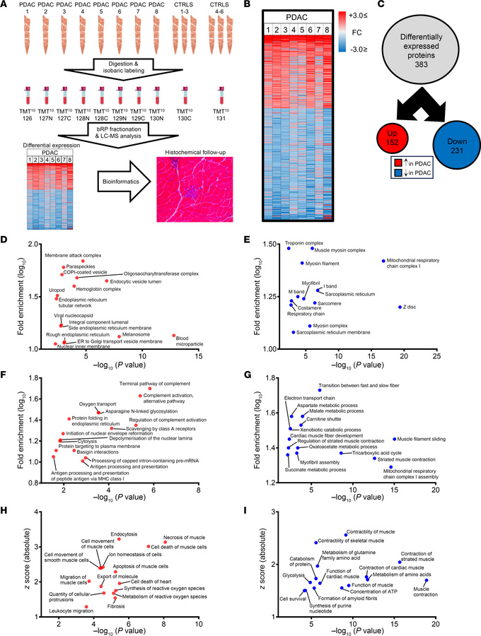 Skeletal muscle proteome is dysregulated in cachectic PDAC patients.
(A)...