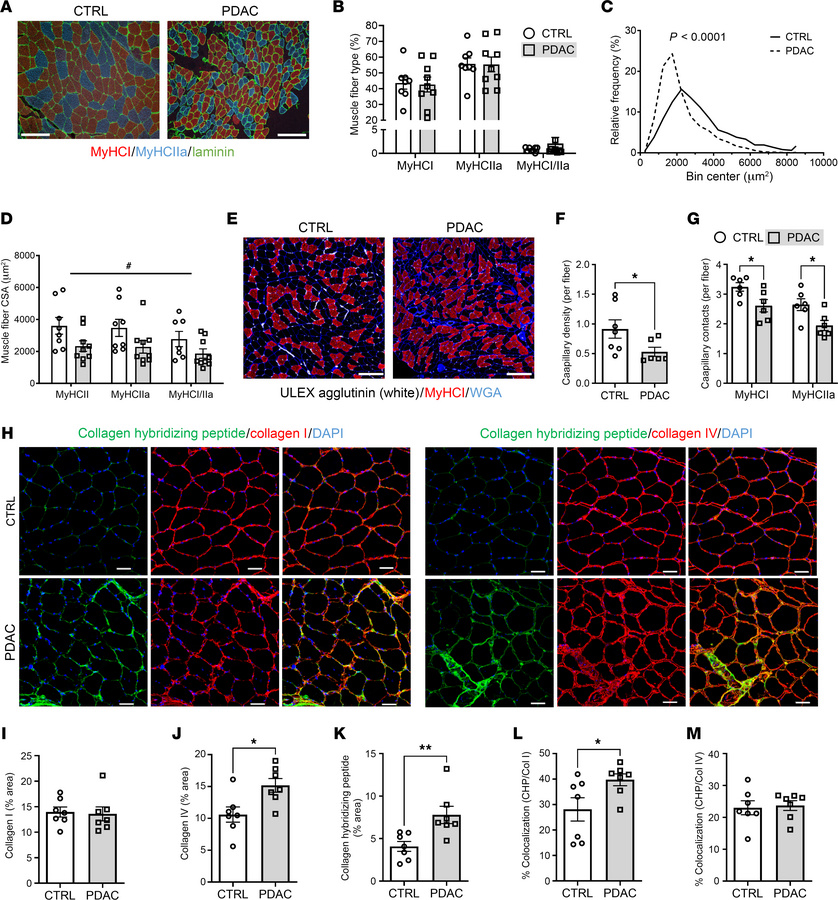 Skeletal muscle of cachectic PDAC patients exhibits worsened morphology ...