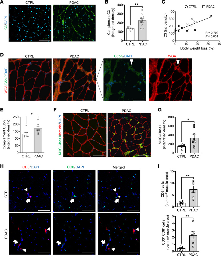 Complement activation in skeletal muscle of cachectic PDAC patients.
(A ...