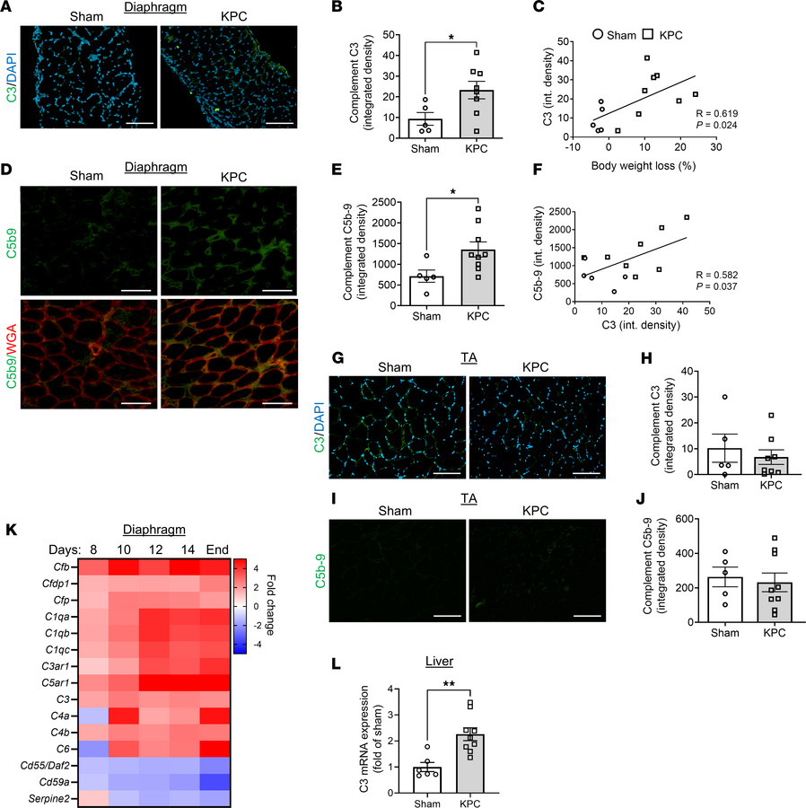Orthotopic KPC model of PDAC-associated cachexia recapitulates skeletal ...