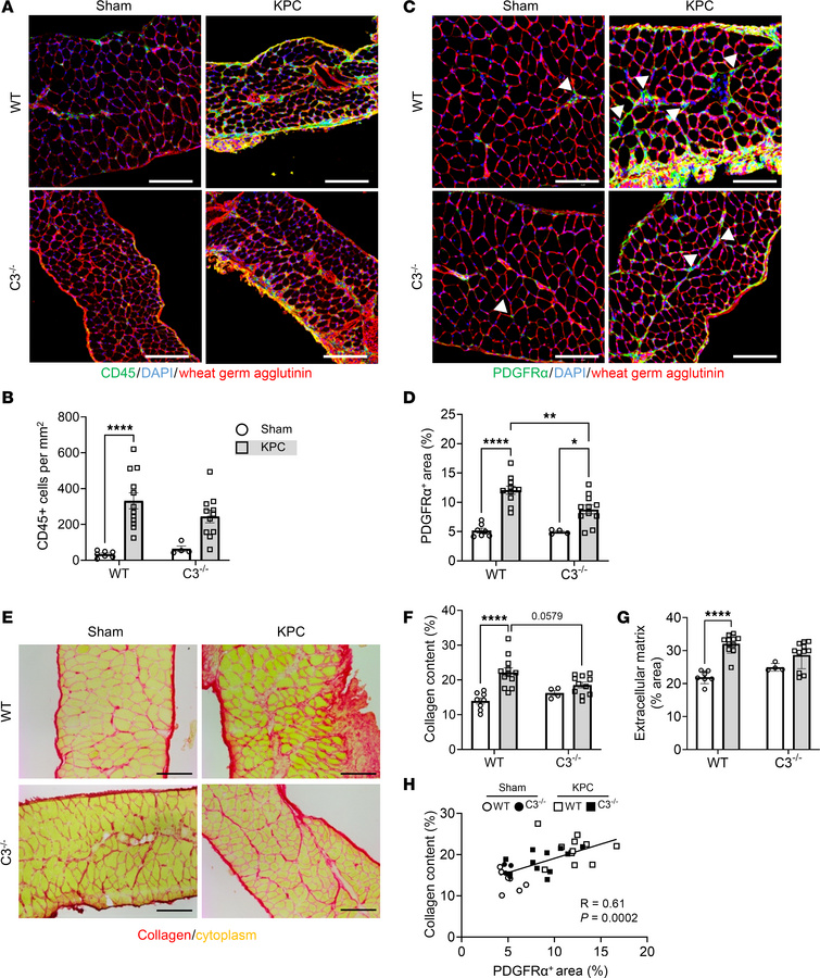 Kpc Cell Line JCI - Complement pathway activation mediates pancreatic cancer–induced ...