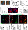 Skeletal muscle of cachectic PDAC patients exhibits worsened morphology and