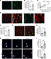 Complement activation in skeletal muscle of cachectic PDAC patients.