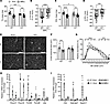 Deletion of C3 attenuates KPC-induced limb muscle wasting.