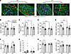 Deletion of C3 ameliorates KPC-induced diaphragm atrophy and fibrosis.