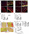 Deletion of C3 attenuates cell infiltration in diaphragm of KPC tumor–beari