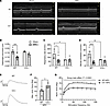 Deletion of C3 preserves in vivo and ex vivo diaphragm function during KPC