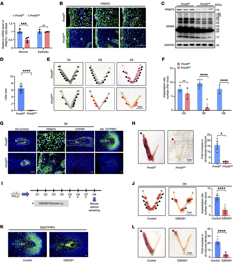 Stromal PRMT5 deficiency impairs endometrial decidualization and embryo ...