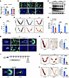 Stromal PRMT5 deficiency impairs endometrial decidualization and embryo dev
