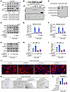 PRMT5-mediated SDMA of Nur77 at R346 is required for decidualization.