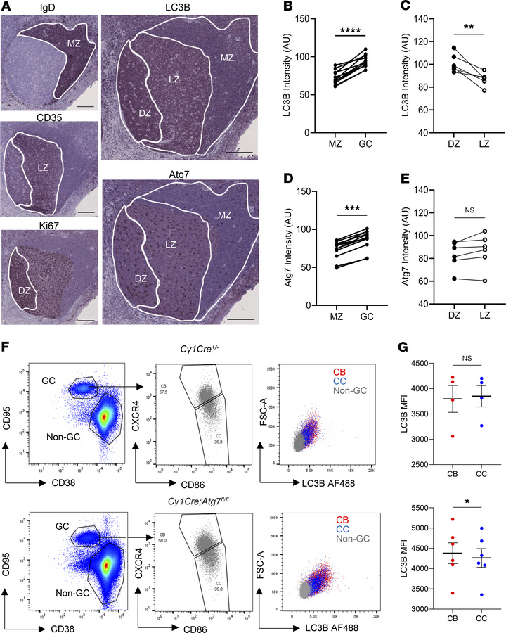 GC B cells upregulate autophagy in the DZ area.
(A) Representative immun...