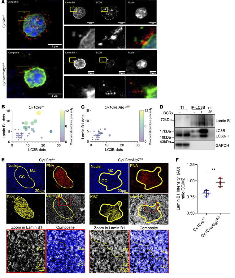 Autophagy directly interacts with lamin B1, controlling its expression, ...