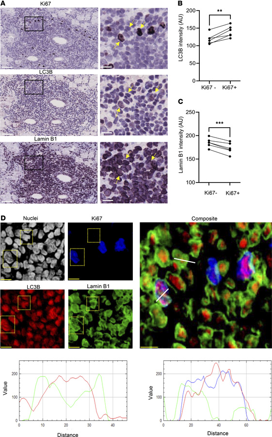 Autophagy–lamin B1 axis is active in autoimmune ectopic lymphoid structu...