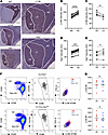 GC B cells upregulate autophagy in the DZ area.