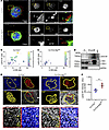Autophagy directly interacts with lamin B1, controlling its expression, in