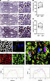 Autophagy–lamin B1 axis is active in autoimmune ectopic lymphoid structures