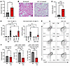 cDC1s are critical for CD25+FoxP3+ T cell induction in cardiac allograft in
