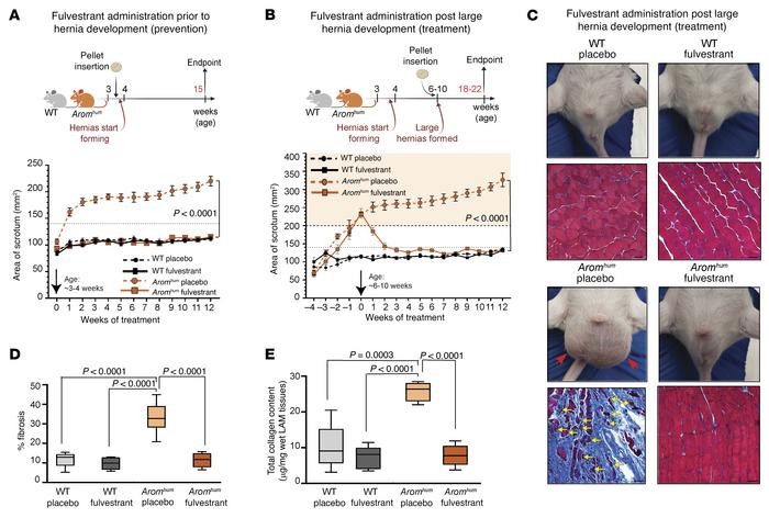 Fulvestrant treatment prevents and reverses well-established large herni...