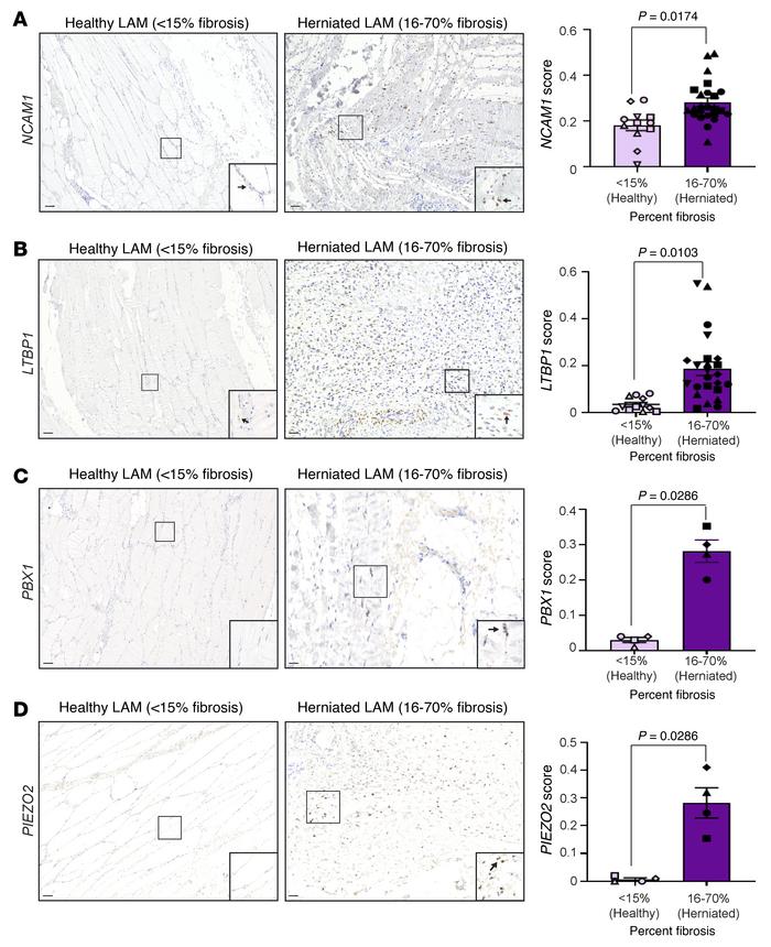 E2/ESR1-modulated genes in men with inguinal hernias.
Representative RNA...