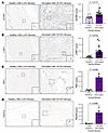 E2/ESR1-modulated genes in men with inguinal hernias.