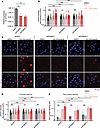 Tazemetostat-induced DNA damage is PGBD5 dependent.