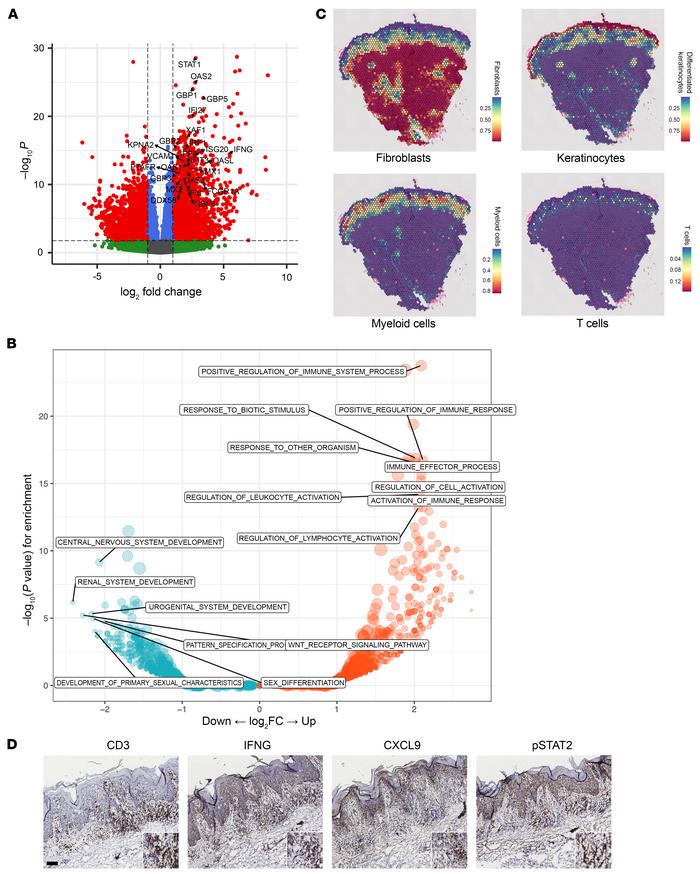 LP is an IFN-driven disease process.
(A) Volcano plot of bulk RNA-Seq da...