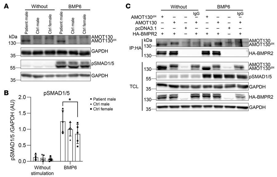 SMAD1/5 phosphorylation level after BMP6 stimulation is slightly higher ...