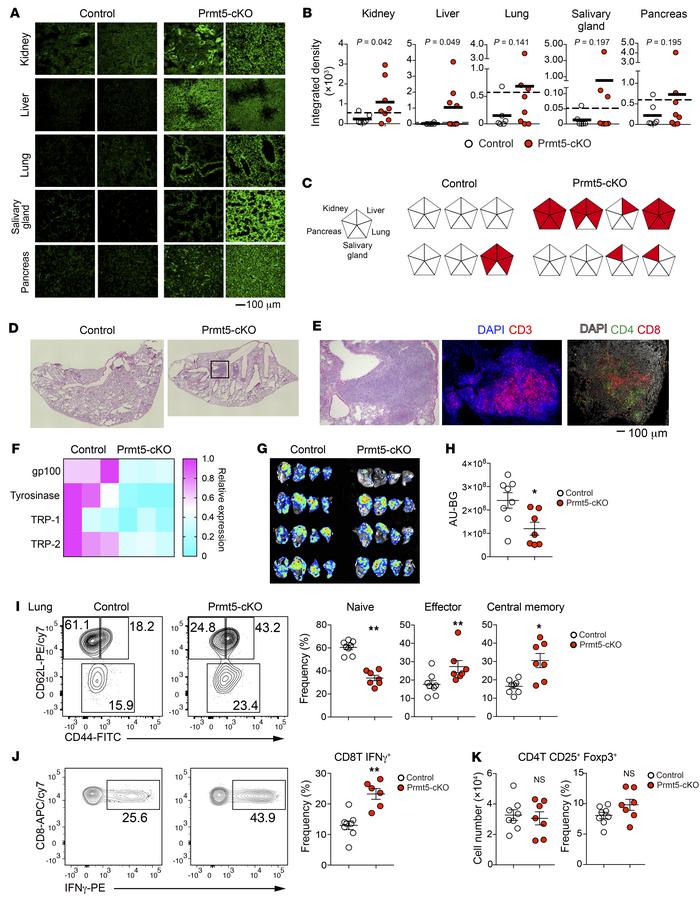 Loss of Prmt5 in TECs causes autoimmunity but reinforces antitumor immun...
