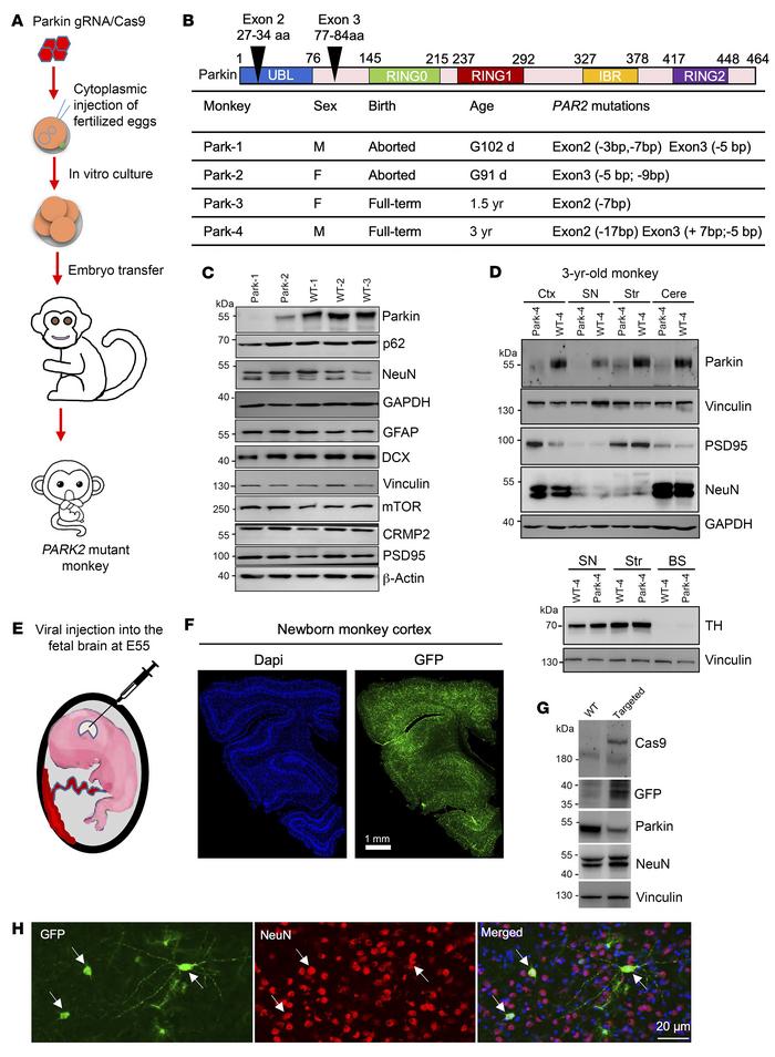 Parkin mutations do not induce neuronal loss in the developing monkey br...