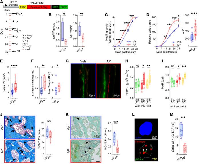 Clearance of p21+ cells accelerates fracture healing by increasing bone ...