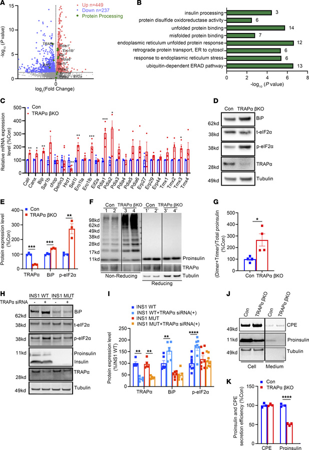 TRAPα is important for β cell ER function, and its deficiency causes PI ...