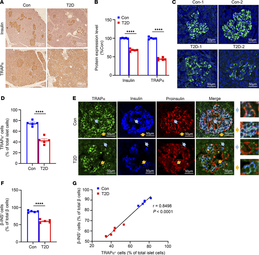 Decreased expression of TRAPα is evident in islets of patients with T2D ...
